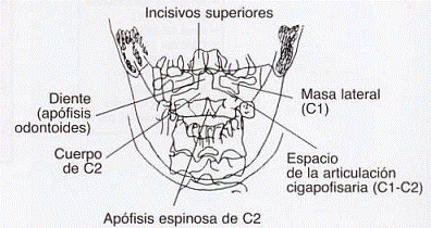 Odontoid visualization